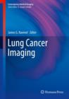 Image for Lung Cancer Imaging