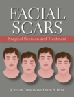 Image for Facial scars  : surgical revision and treatment