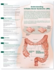 Image for Understanding Irritable Bowel Syndrome Anatomical Chart