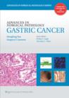 Image for Gastric cancer