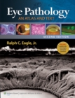 Image for Eye Pathology: An Atlas and Text