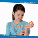 Image for Rashes