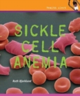 Image for Sickle Cell Anemia