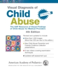 Image for Visual Diagnosis of Child Abuse : The AAP Resource of Visual Findings of Child Abuse for Medical Providers
