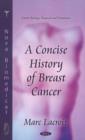 Image for Concise History of Breast Cancer