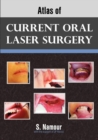 Image for Atlas of Current Oral Laser Surgery
