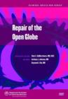 Image for Repair of the Open Globe