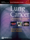 Image for Lung cancer: a multidisciplinary approach to diagnosis and management