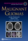 Image for Malignant gliomas