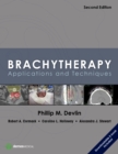 Image for Brachytherapy: applications and techniques