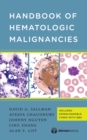 Image for Handbook of Hematologic Malignancies