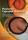Image for Posterior Capsular Rupture : A Practical Guide to Prevention and Management
