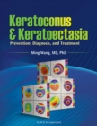 Image for Keratoconus and Keratoectasia: Prevention, Diagnosis, and Treatment