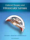 Image for Cataract surgery and intraocular lenses