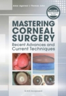 Image for Mastering corneal surgery  : recent advances and current techniques