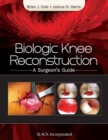 Image for Biologic Knee Reconstruction : A Surgeon&#39;s Guide