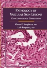 Image for Pathology of Vascular Skin Lesions