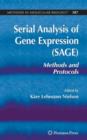 Image for Serial Analysis of Gene Expression (SAGE)