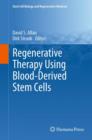 Image for Regenerative Therapy Using Blood-Derived Stem Cells