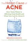 Image for The hidden cause of acne: how toxic water is affecting your health and what you can do about it