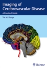 Image for Imaging of cerebrovascular disease  : a practical guide