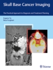 Image for Skull Base Cancer Imaging : The Practical Approach to Diagnosis and Treatment Planning