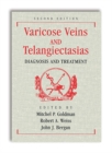 Image for Varicose Veins and Telangiectasias: Diagnosis and Treatment, Second Edition