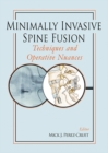 Image for Minimally Invasive Spine Fusion: Techniques and Operative Nuances