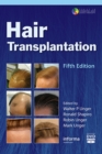Image for Hair Transplantation