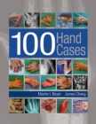 Image for 100 Hand Cases