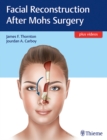 Image for Facial Reconstruction After Mohs Surgery