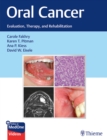 Image for Oral Cancer : Evaluation, Therapy, and Rehabilitation