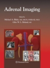 Image for Adrenal Imaging