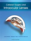 Image for Cataract Surgery and Intraocular Lenses.