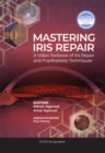 Image for Mastering Iris Repair : A Video Textbook of Iris Repair and Pupilloplasty Techniques