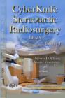 Image for CyberKnife Stereotactic Radiosurgery