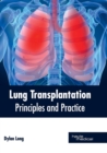 Image for Lung Transplantation: Principles and Practice