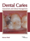 Image for Dental Caries: Assessment and Clinical Management