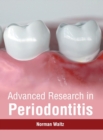 Image for Advanced Research in Periodontitis