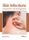 Image for Skin Infections: Assessment and Management
