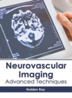 Image for Neurovascular Imaging: Advanced Techniques
