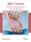 Image for Skin Cancer: Pathophysiology, Diagnosis and Management