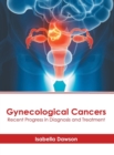 Image for Gynecological Cancers: Recent Progress in Diagnosis and Treatment