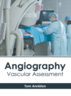 Image for Angiography: Vascular Assessment