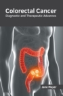 Image for Colorectal Cancer: Diagnostic and Therapeutic Advances