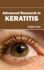 Image for Advanced Research in Keratitis