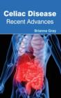 Image for Celiac Disease: Recent Advances