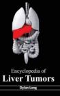 Image for Encyclopedia of Liver Tumors