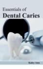 Image for Essentials of Dental Caries