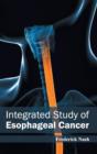Image for Integrated Study of Esophageal Cancer